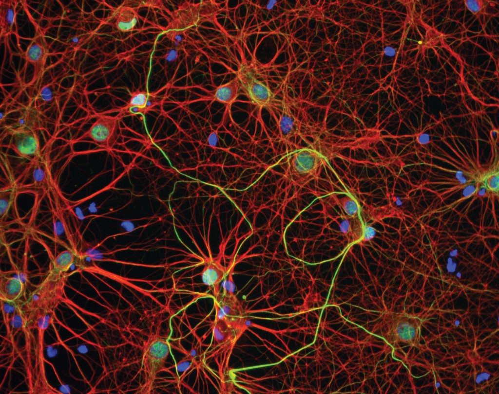 нейроны коры головного мозга мыши